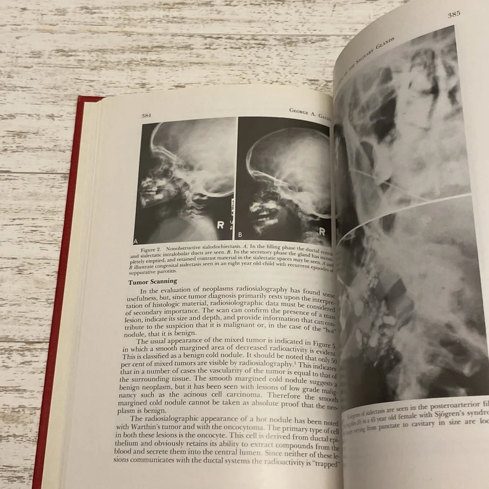 Vintage 1977 Otolaryngologic Clinics North America Salivary Gland Book